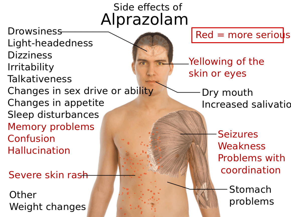 Main side effects of alprazolam, also known as Xanax