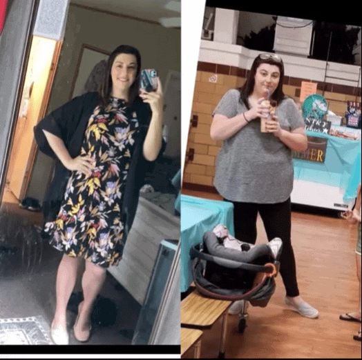 75 lb wegovy weight loss before after