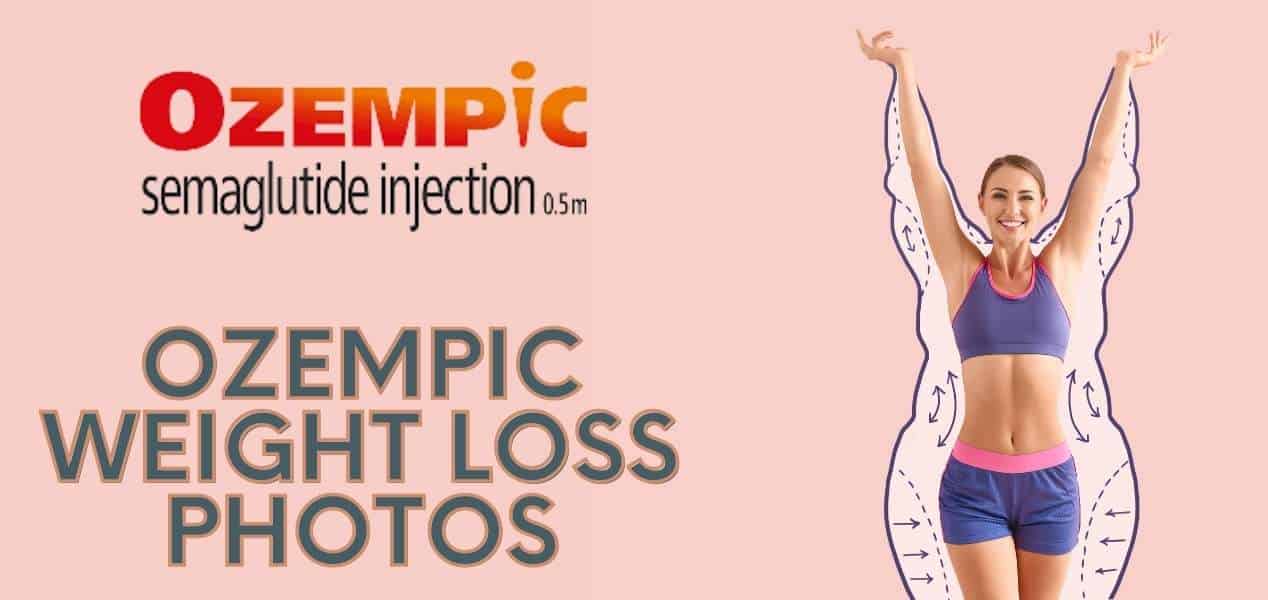 Ozempic Weight Loss Before And After Pictures Videos Drug Genius