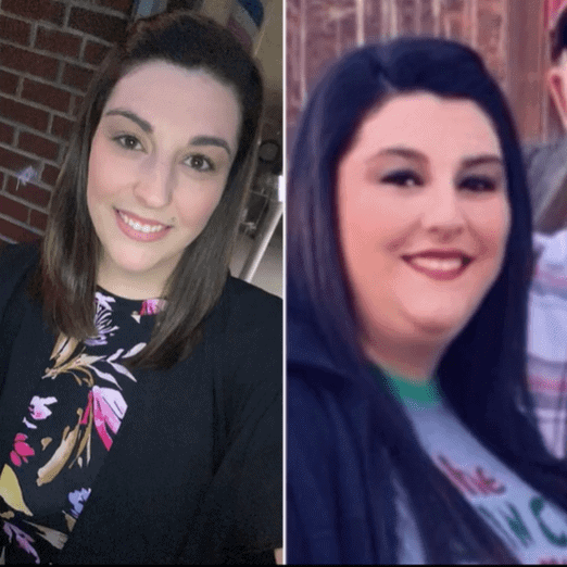 wegovy face weight loss