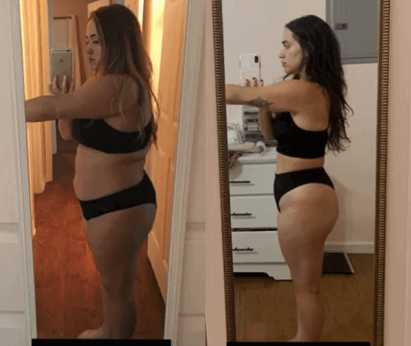 Ozempic Weight Loss Before And After Pictures Videos An T m