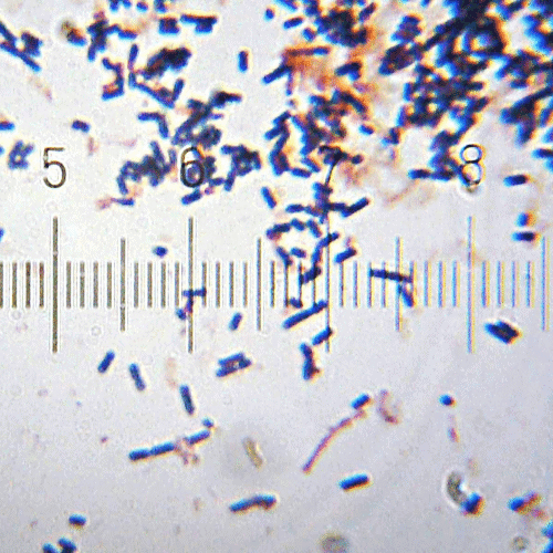 Lactobacillus Acidophilus under microscope